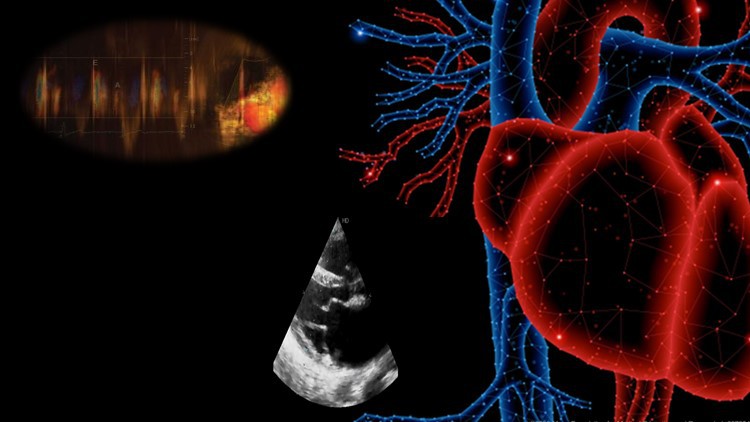 Read more about the article [100% Off] Echocardiography Board Review Exam Preparation – Mock Exam